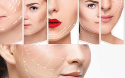 Căng da toàn phần tại thẩm mỹ viện uy tín