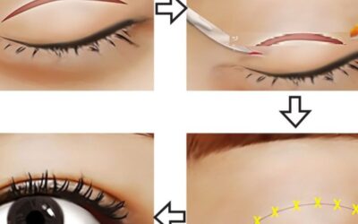 Thẩm mỹ viện uy tín gần đây