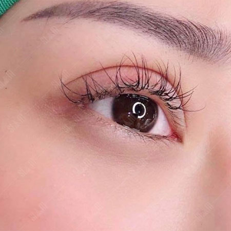 cắt mí mắt cắt mí mắt