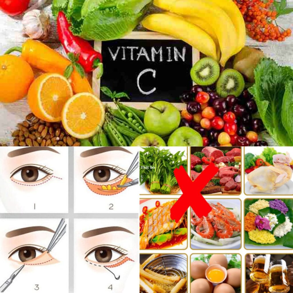 Lưu ý trước và sau khi cắt mí để không bị biến chứng 4 Sau khi cắt mí nên ăn gì? Sau khi cắt mí không nên ăn gì?