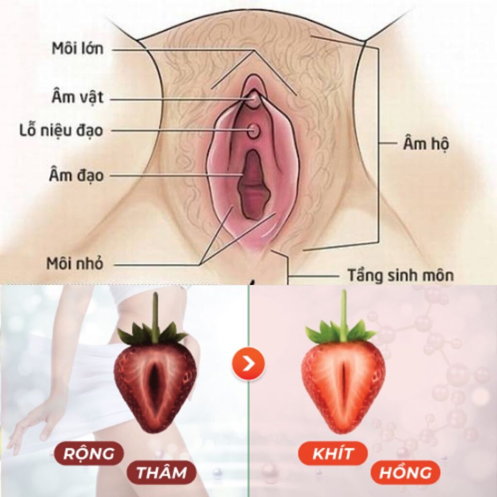 Có nên cắt môi cô bé không