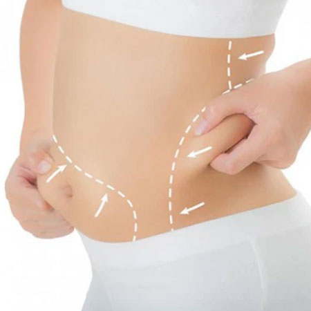 hút mỡ bụng tại tmnd hút mỡ bụng tại tmnd