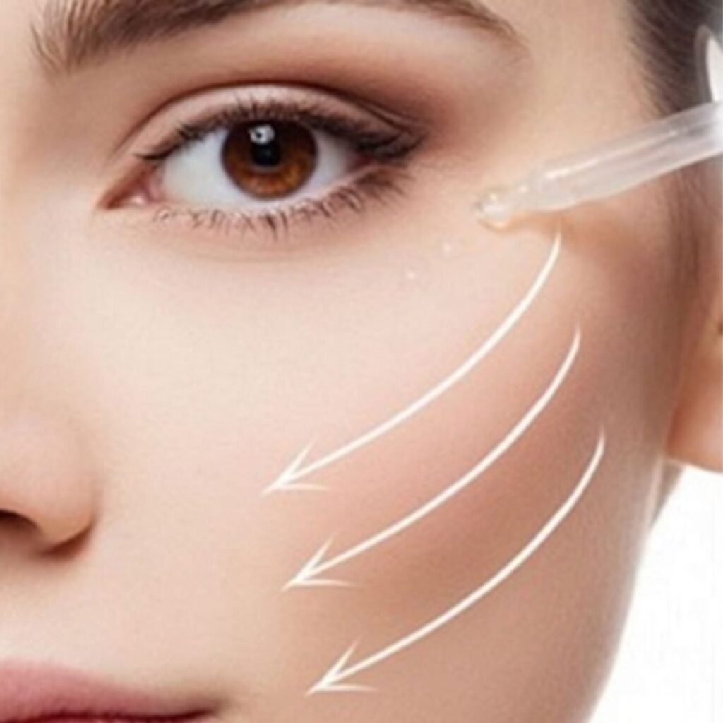 Nâng cơ mặt không xâm lấn bằng HIFU - Phù hợp với ai? 4 Quy trình nâng cơ mặt bằng HIFU chuẩn y khoa