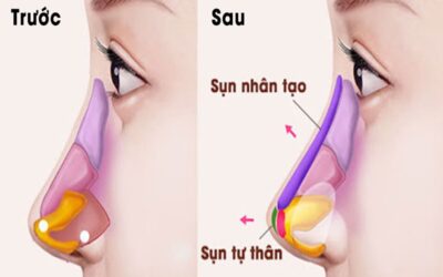 Nên chọn thẩm mỹ viện uy tín hay bệnh viện thẩm mỹ?