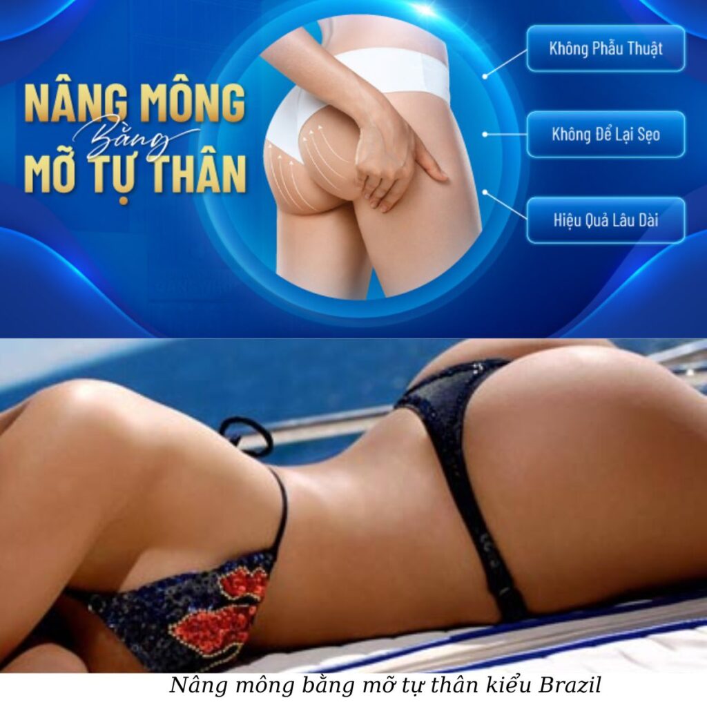 Thẩm mỹ viện Cần Thơ nâng mông đẹp, chuyên nghiệp 2 Nâng mông bằng mỡ tự thân kiểu Brazil