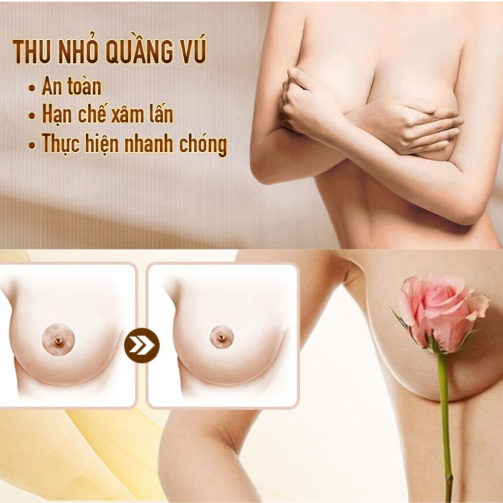 Thu gọn quầng nhũ hoa hiệu quả tại thẩm mỹ viện Cần Thơ 3 Thu gọn quần ngựa hoa có an toàn và hiệu quả không?