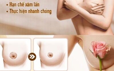 Thu gọn quầng nhũ hoa hiệu quả tại thẩm mỹ viện Cần Thơ