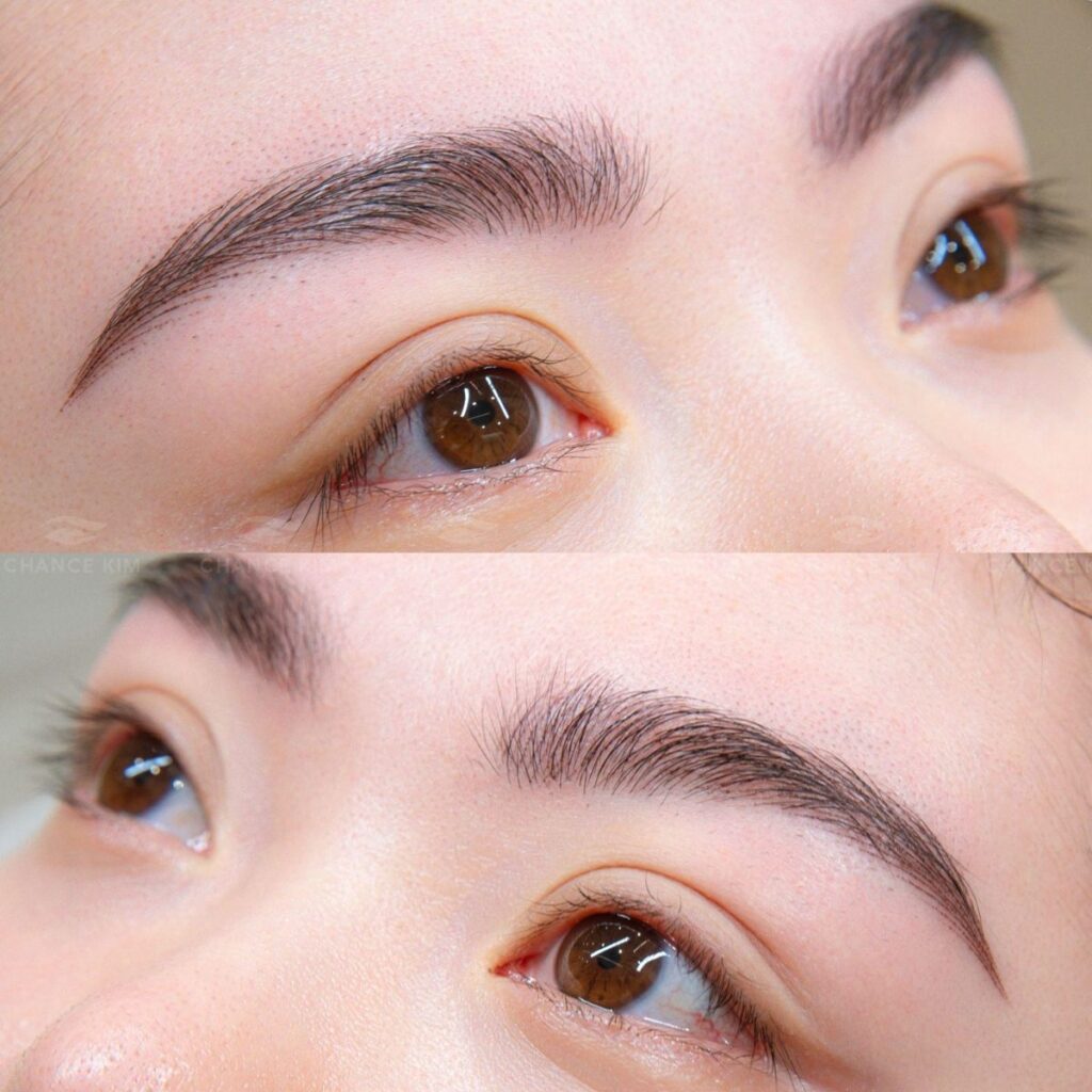 Làm đẹp không phẫu thuật