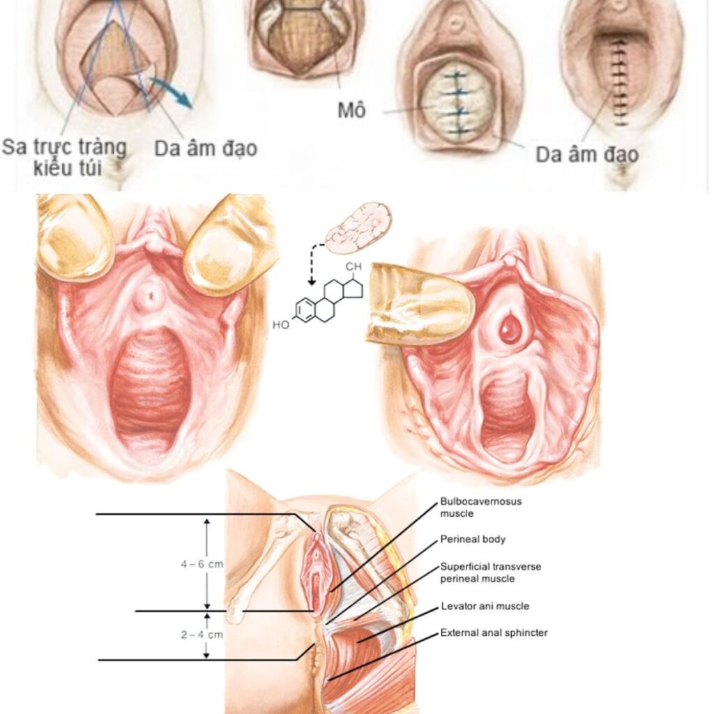 Phẫu thuật vùng kín