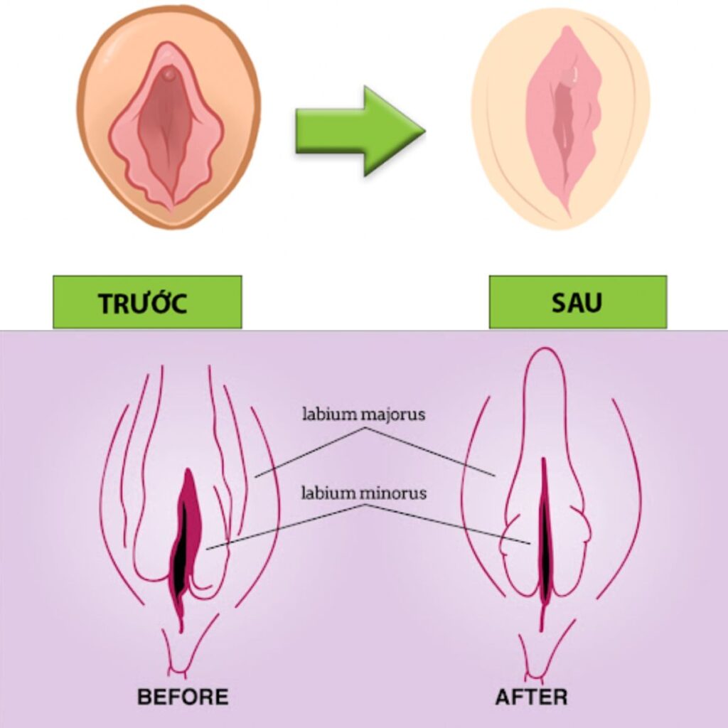 Tái tạo điểm G – Khơi dậy cảm xúc thăng hoa