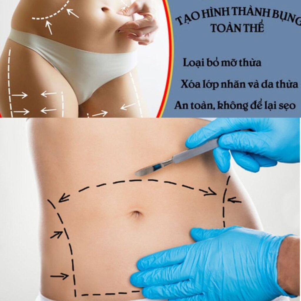 Quy trình thực hiện phẫu thuật