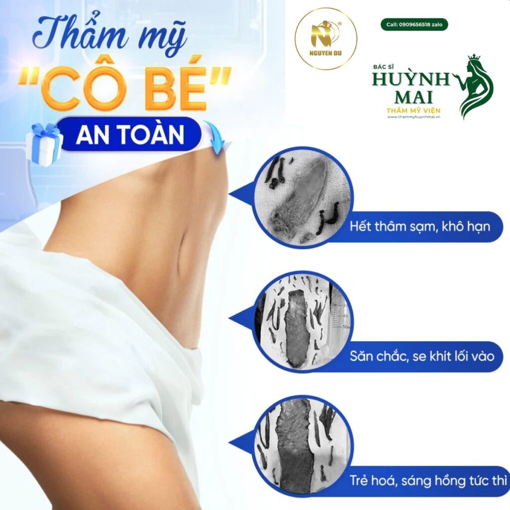 Thẩm mỹ viện uy tín ở Cần Thơ ở đâu tốt ? 4 Thẩm mỹ cô bé tại thẩm mỹ viện uy tín ở cần thơ