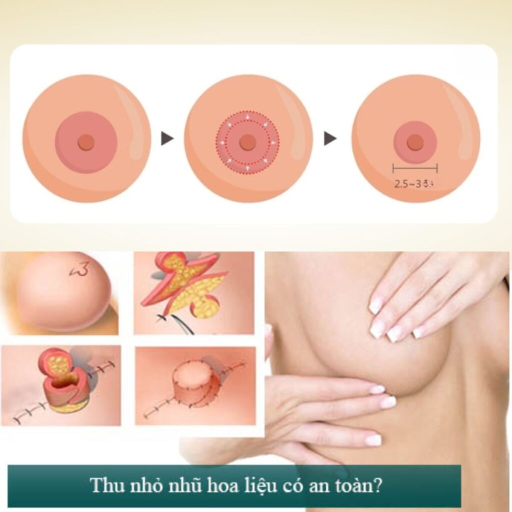 Thu gọn đầu ti bút bi