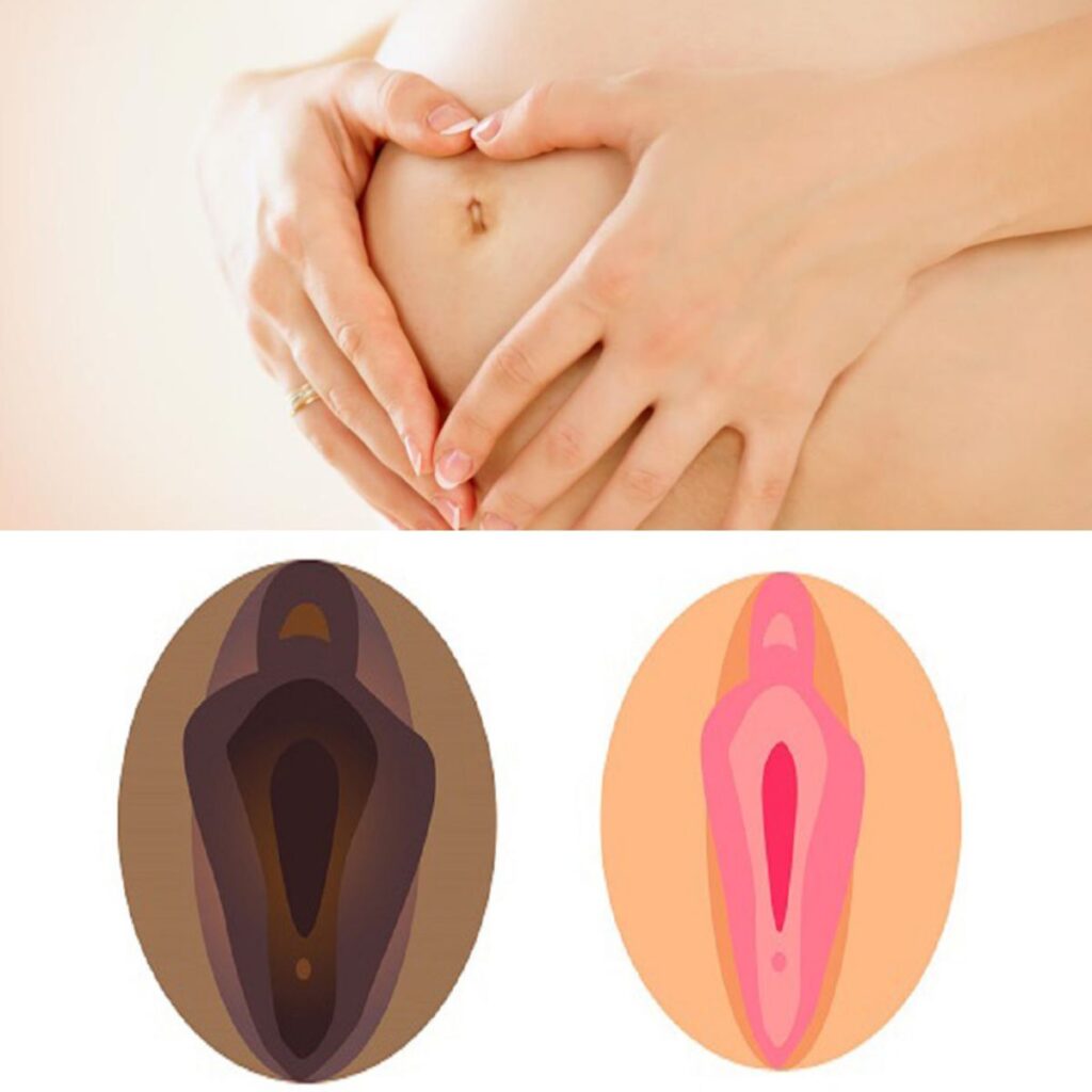 Nguyên nhân khiến âm đạo giãn rộng và lão hóa nhanh