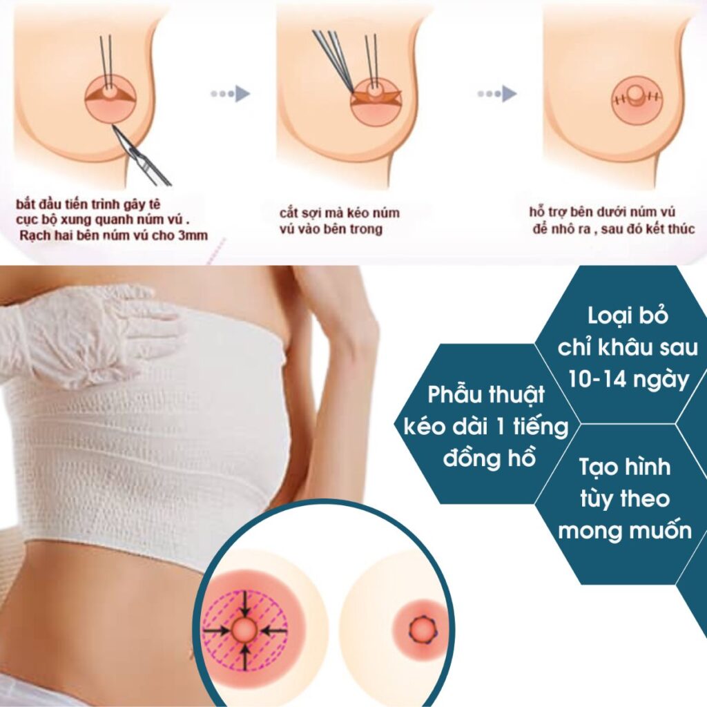 Quá trình thu nhỏ đầu ti bút bi