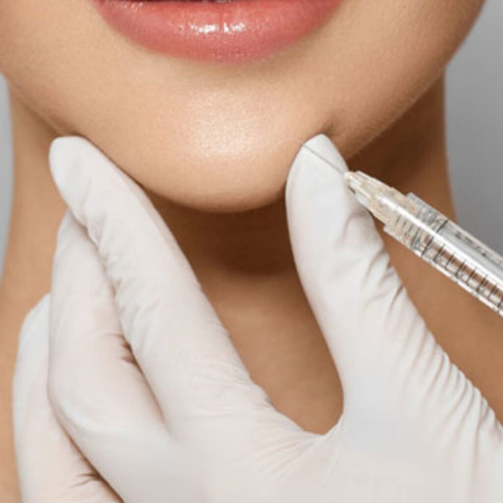 Độn cằm V-line có đau không? Phẫu thuật hay tiêm filler tốt hơn? 4 Tiêm filler độn cằm