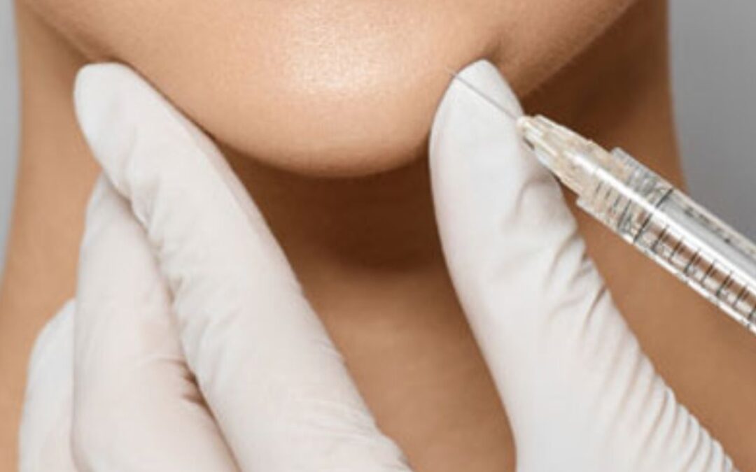 Độn cằm V-line có đau không? Phẫu thuật hay tiêm filler tốt hơn?