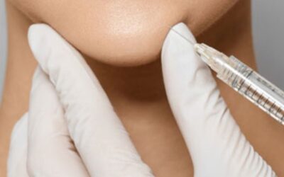 Độn cằm V-line có đau không? Phẫu thuật hay tiêm filler tốt hơn?