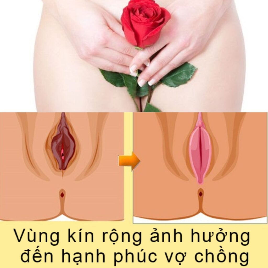 Vùng kín ảnh hướng đến tình dục vợ chồng như thế nào?