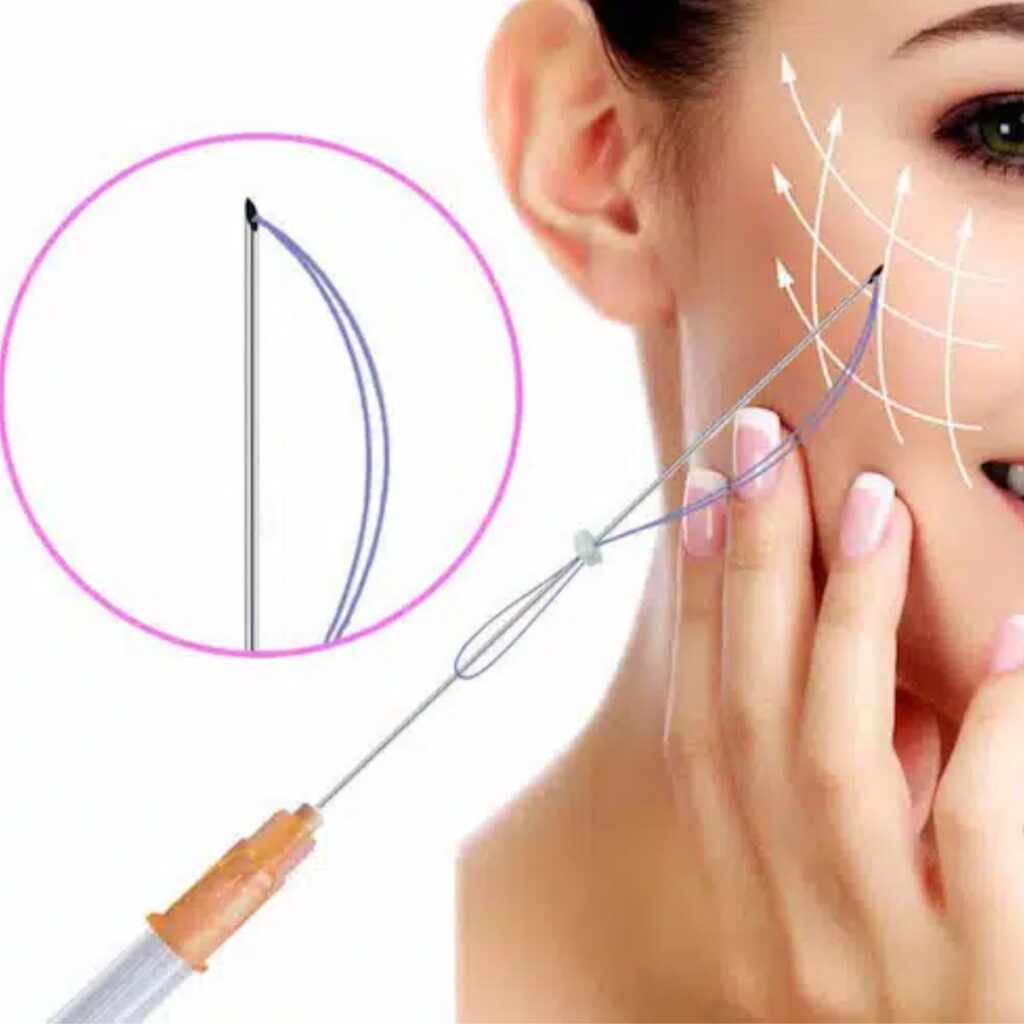 Chỉ Collagen là gì và cơ chế hoạt động?