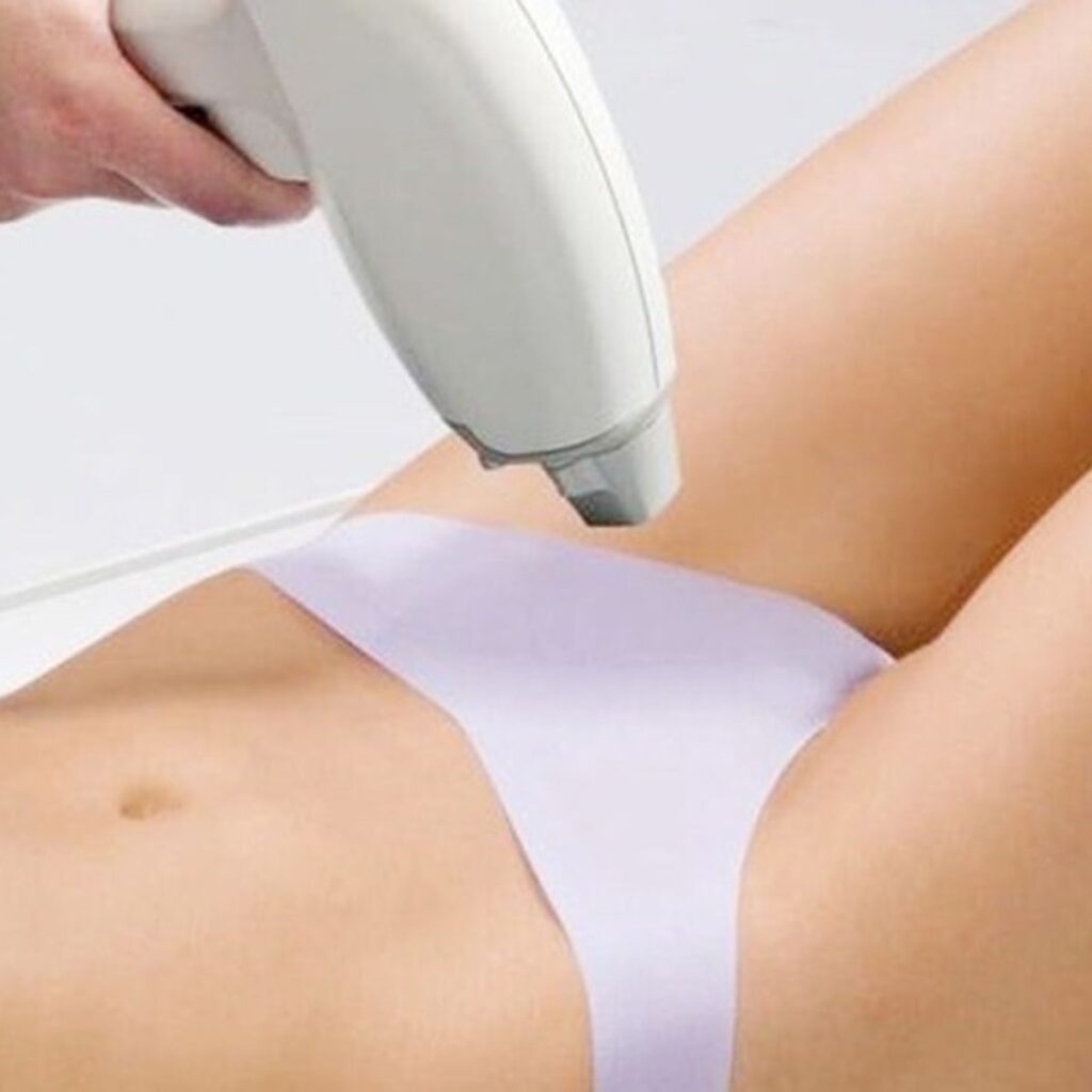 Thu hẹp âm đạo – Trẻ hóa toàn diện vùng kín