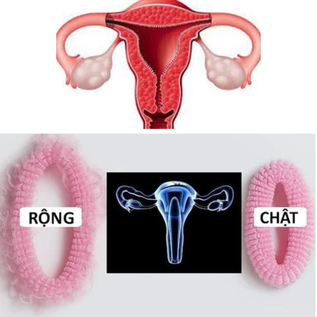 Tái tạo điểm G - thu hẹp âm đạo thẩm mỹ viện uy tín Cần thơ 