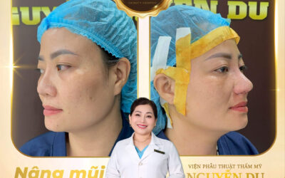 Home 02 1 Nâng Mũi Tại Cần Thơ Giá Bao Nhiêu? Bảng Giá Mới Nhất 2026