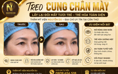 Home 02 1 Treo Cung Chân Mày Ở Cần Thơ – Trẻ Hóa Gương Mặt Về Tuổi 18