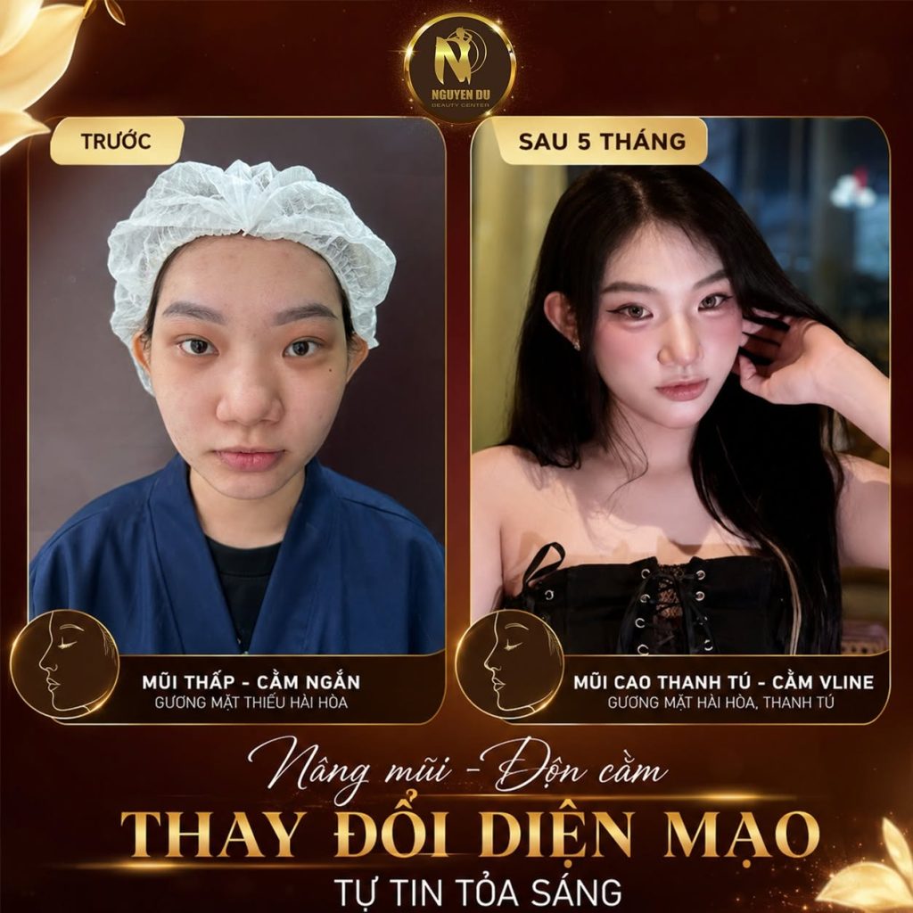 Review Thẩm Mỹ Viện Nguyễn Du Cần Thơ