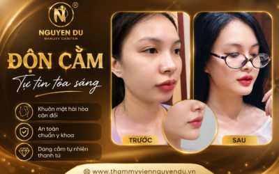 Home 02 2 Độn cằm ở Cần Thơ chổ nào uy tín – an toàn – giá hợp lý