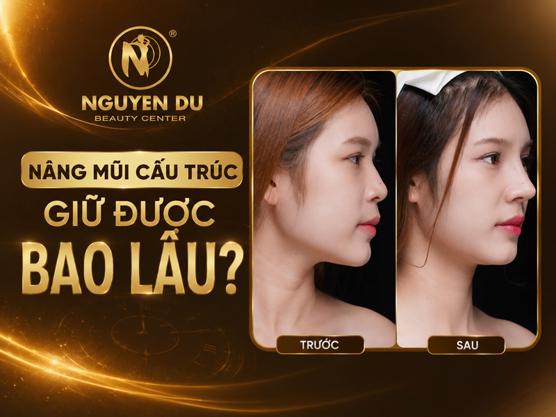 Nâng Mũi Cấu Trúc Giữ Được Bao Lâu? 1 Nâng Mũi Cấu Trúc Giữ Được Bao Lâu?