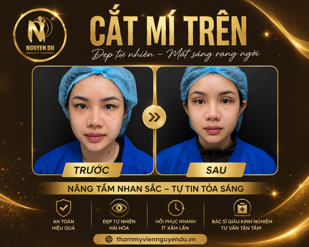 Cắt Mí Trên Giá Bao Nhiêu?