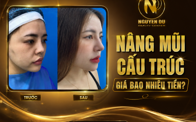 Nâng mũi cấu trúc giá bao nhiêu tiền? Giá cụ thể mới nhất