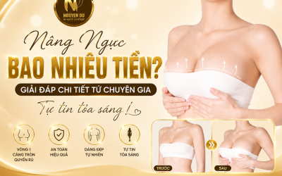 Nâng Ngực Bao Nhiêu Tiền? Giải Đáp Chi Tiết Từ Chuyên Gia