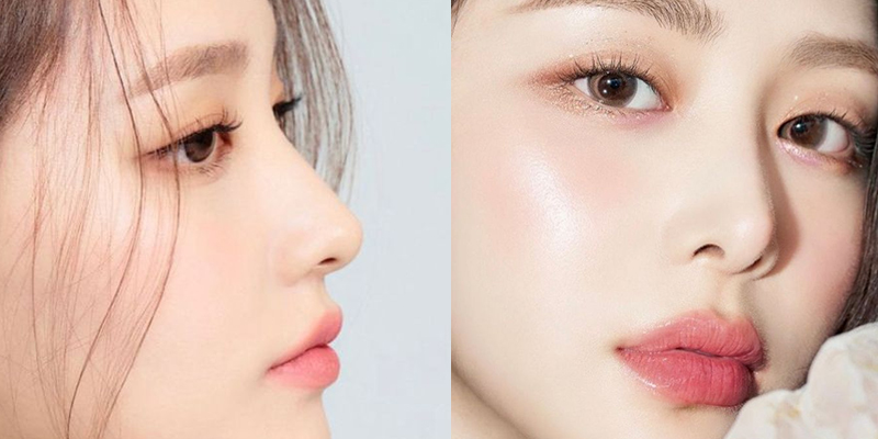 Sửa Mũi Lần Hai Cần Lưu Ý Gì? Những Điều Cần Biết Trước Khi Phẫu Thuật 2 Khi nào sửa mũi
