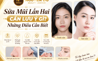 Home 02 7 Sửa Mũi Lần Hai Cần Lưu Ý Gì? Những Điều Cần Biết Trước Khi Phẫu Thuật